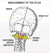 Upper Cervical Care is Safe and Gentle